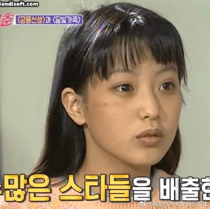 金喜善哪怕是让妆，恐怖的灯光，还是很美的。她年轻时候最美的时候真的没有整容，双眼皮，脸型都不对称，但