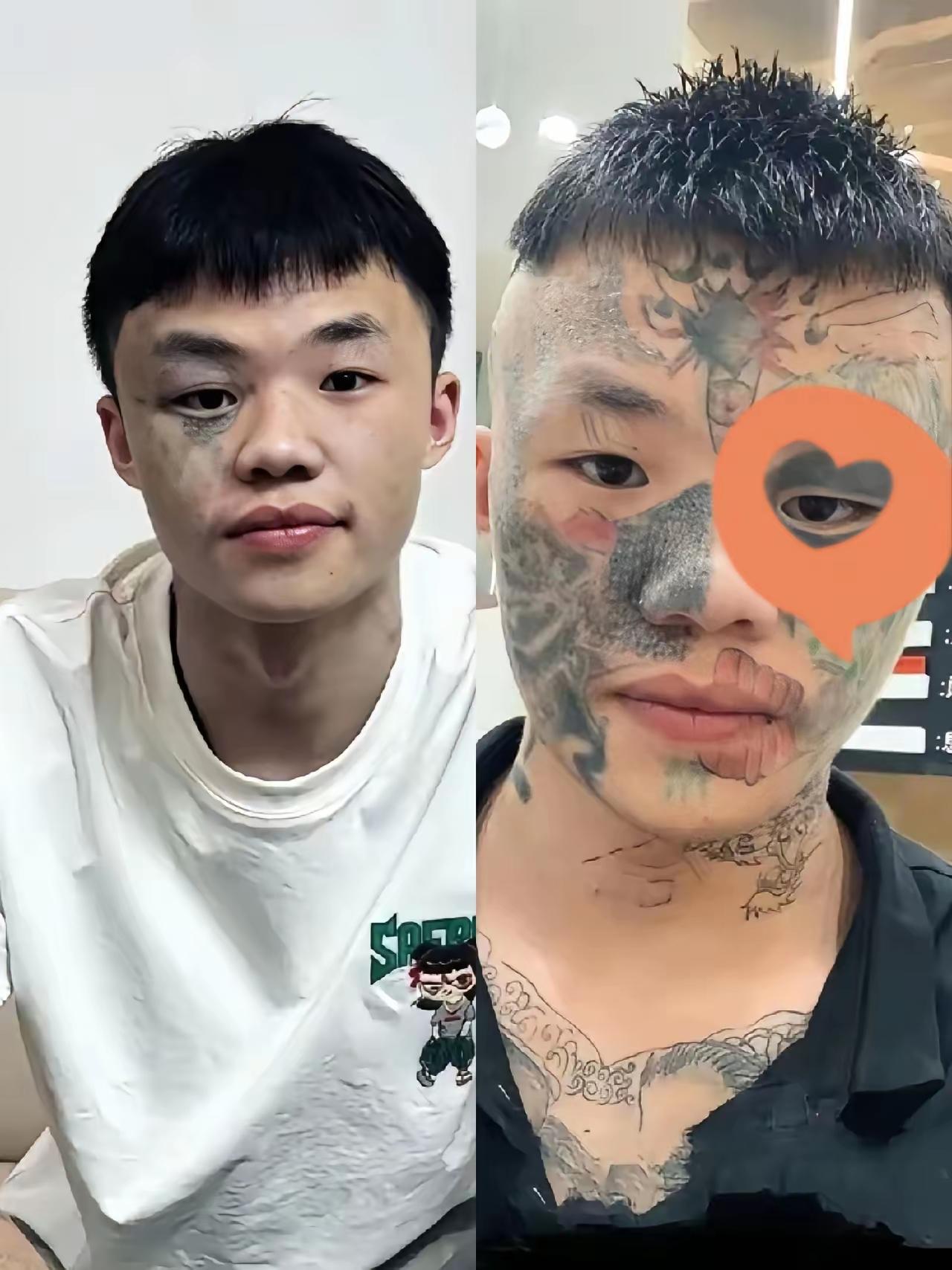 从网上流出来的照片看，广东纹面男孩夏朝勇脸上的纹身洗得效果还不错，感觉干净了很多