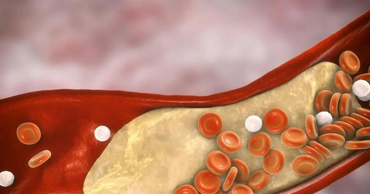 血脂高到睡不着？2022膳食指南一锤定音，核桃竟逆转血管危机，补脑神话真假大曝光