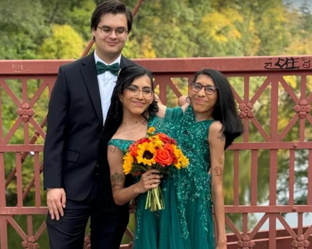 共用生殖系统的连体姐妹中的妹妹结婚了，妹妹同房时姐姐怎么办？大家怎么看，一起评