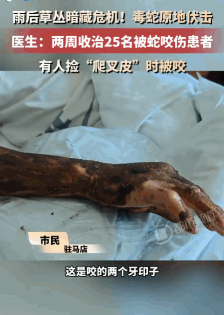 悲剧还是发生了！河南，一男子雨后去草丛捡拾“爬叉皮”时，被突然窜出的毒蛇死死咬住