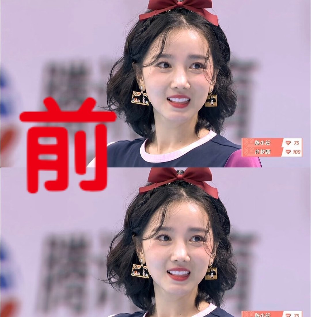 谁能想到如今陈小纭的脸居然变成这样了，根本认不出​