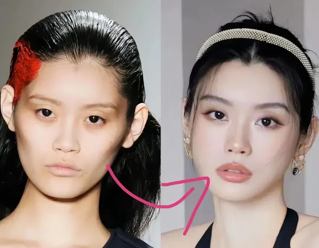 奚梦瑶还真不把我们当外人啊！她在节目里就大大方方自曝过自己也医美过，尤其是在脸上