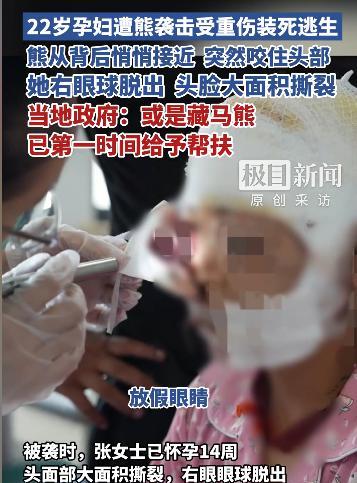 “这就是命啊！”近日，甘肃，一孕妇在野外放牧时，突然被一头黑熊袭击，孕妇的头部瞬