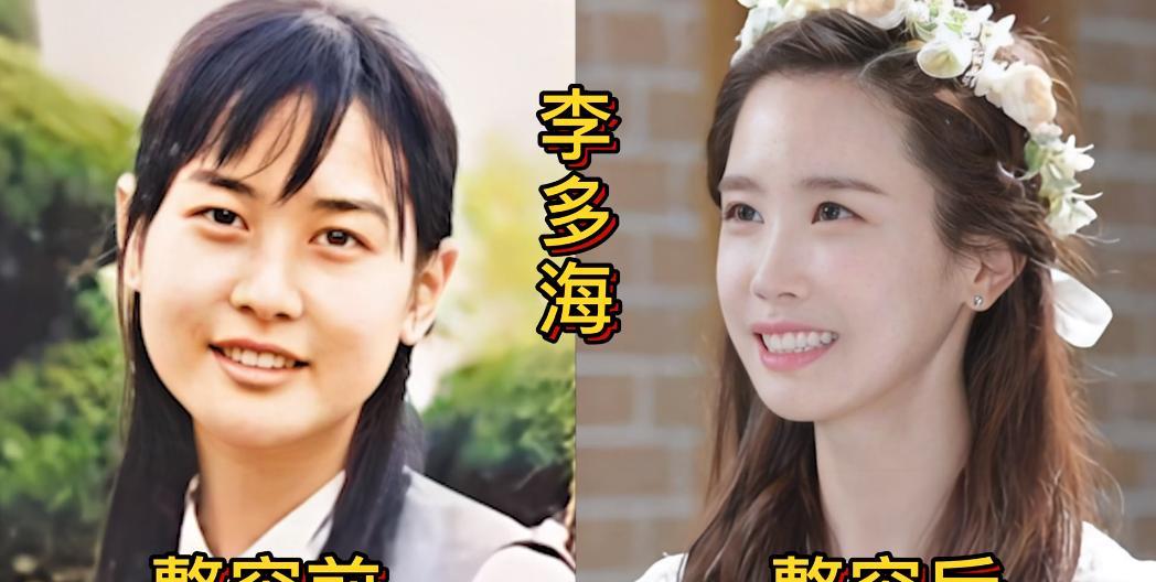 荧幕上那些漂亮的韩国女星，你知道她们从前的容貌是啥样吗？如果看到没整容之前的长相