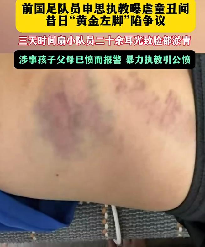 一段青训训练场的监控视频近日在网络流传，画面里前国脚申思当众掌掴参训孩童，发力过