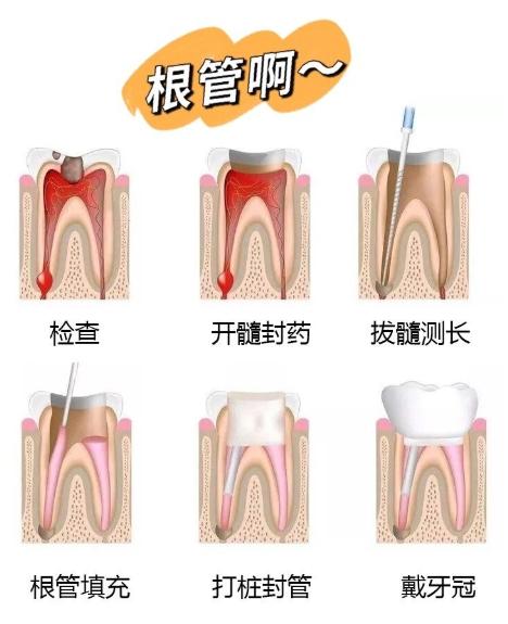 持续牙疼，但是吃甲硝锉能缓解，那还要去看牙吗？牙疼持续的话肯定不正常，说明有