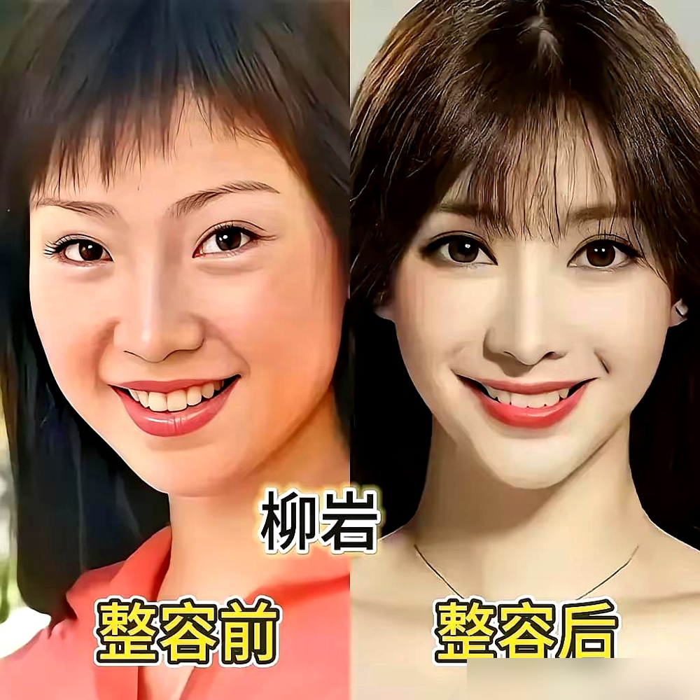 何炅当着镜头问沈梦辰：你是不是微调了？她直接回了一句，对，我做了。还说自己早年填太狠，脸僵得像戴了面