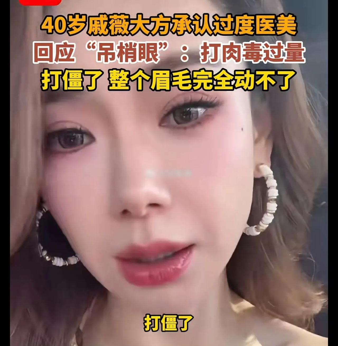 看戚薇说打肉毒把眉毛整僵了，突然觉得这姐们儿是真敢说啊。你说现在这情况，是