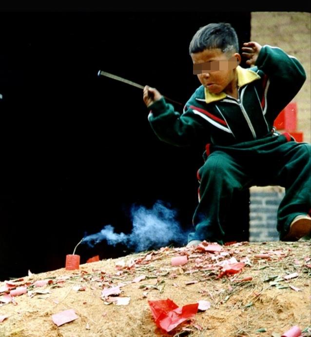 山东枣庄，8岁男童在小区放鞭炮，不小心炸伤邻居家的4岁小孩，致其鼻部十级伤残，脸