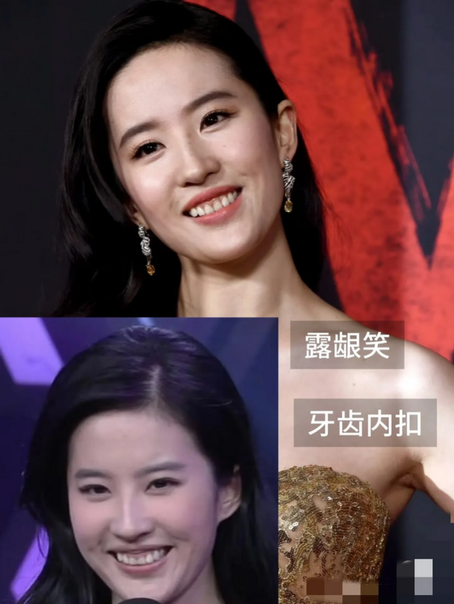 刘亦菲牙齿成谜！