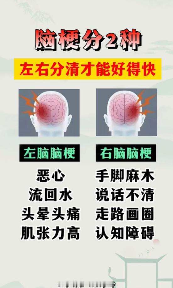 脑梗分左右两种，症状各不相同，千万别混淆