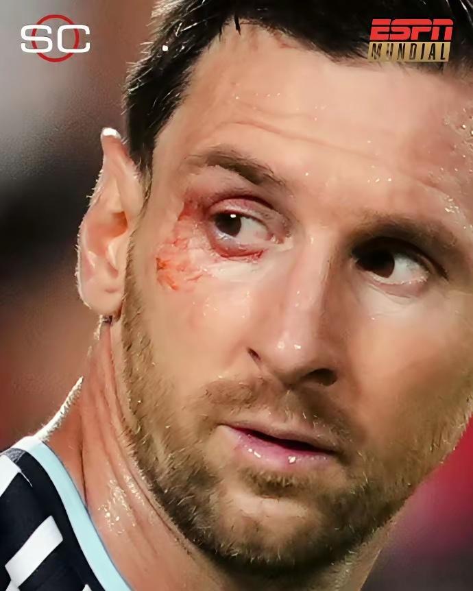 有件事，我一直不敢说。评论区现在疯传一种说法，说FIFA偏袒阿根廷，理...