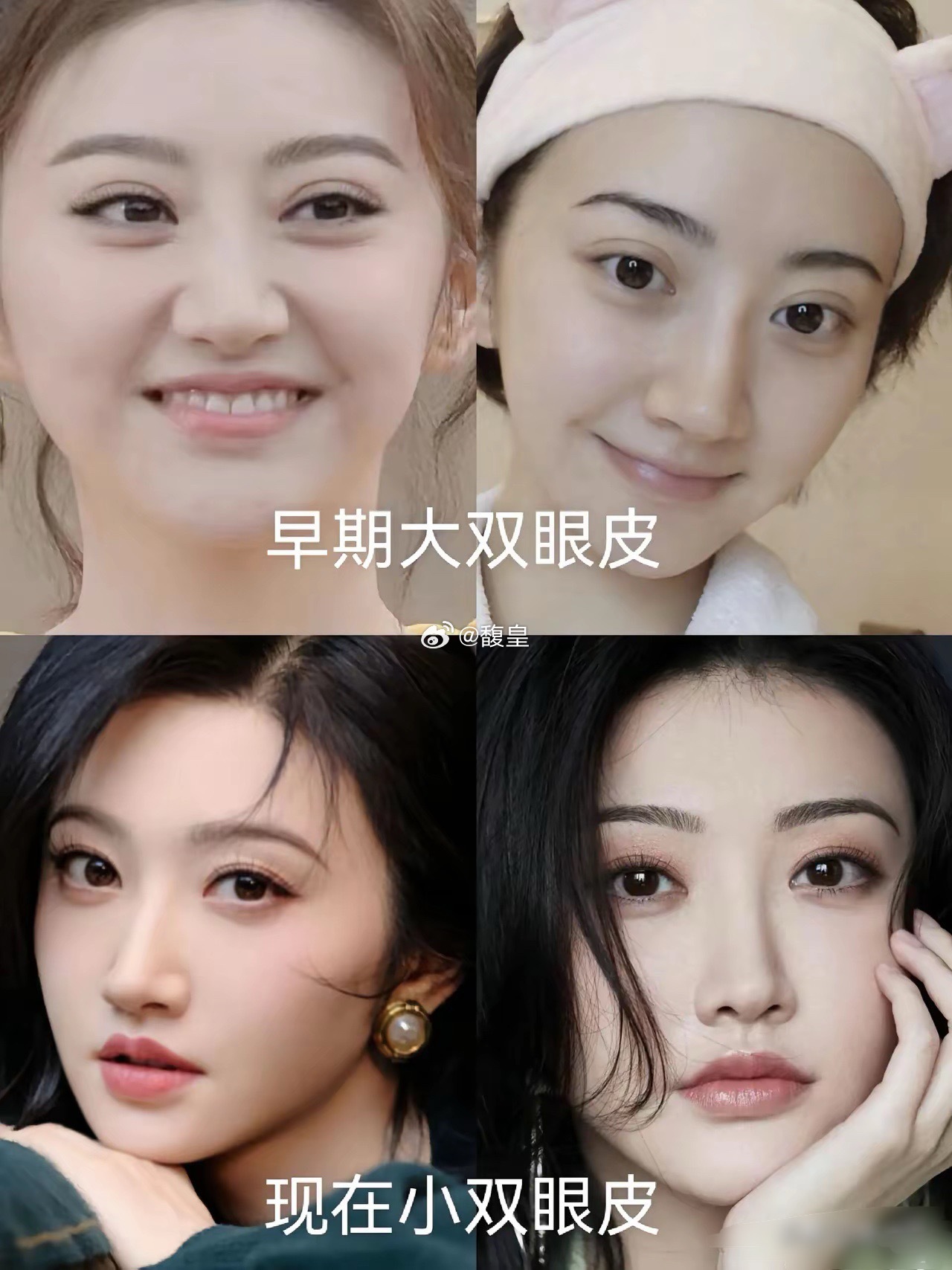 景甜早期悲伤蛙的大双眼皮真的耽误颜值，还好后面调回来了！​​​