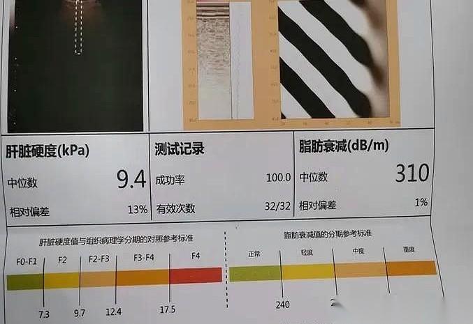 诊室里，一个男人把手放在膝盖上，指尖一下下敲着裤子。他吃了两年抗病毒药，人看着