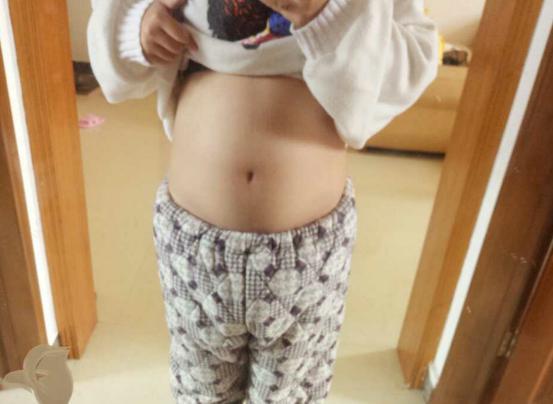 1月10的预产期, 今天38+4剖腹产5斤3两女宝宝, 分享孕期症状