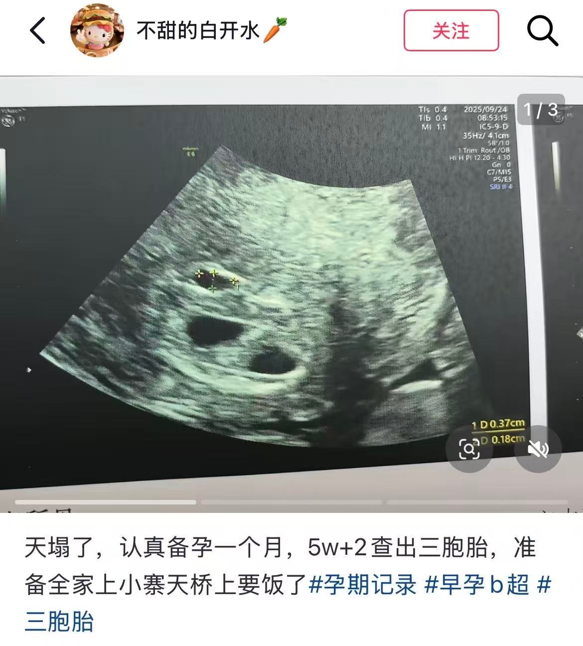 网友的嘴跟淬了毒一样哈哈哈哈作者打开评论区一看天塌了​​​