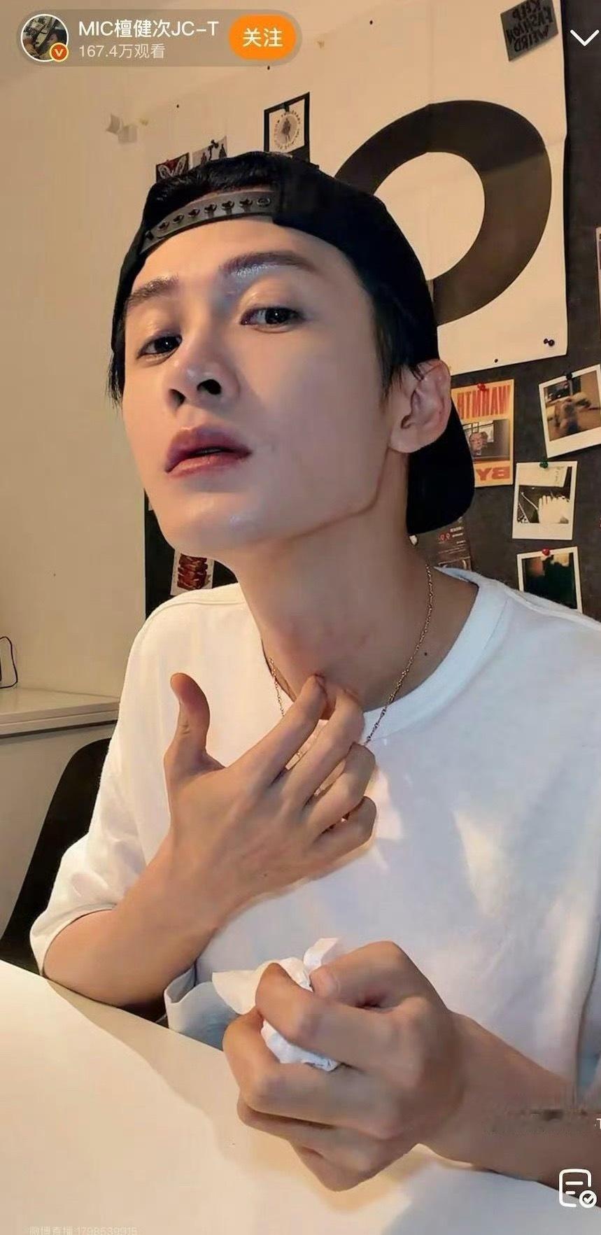檀健次脖子咋了看着像荨麻疹