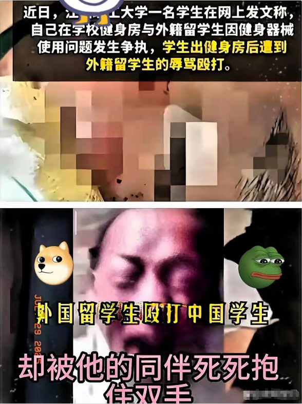 复旦大学这事儿真让人火大！中国学生被印度留学生打了，监控、验伤单、报警记录全都有