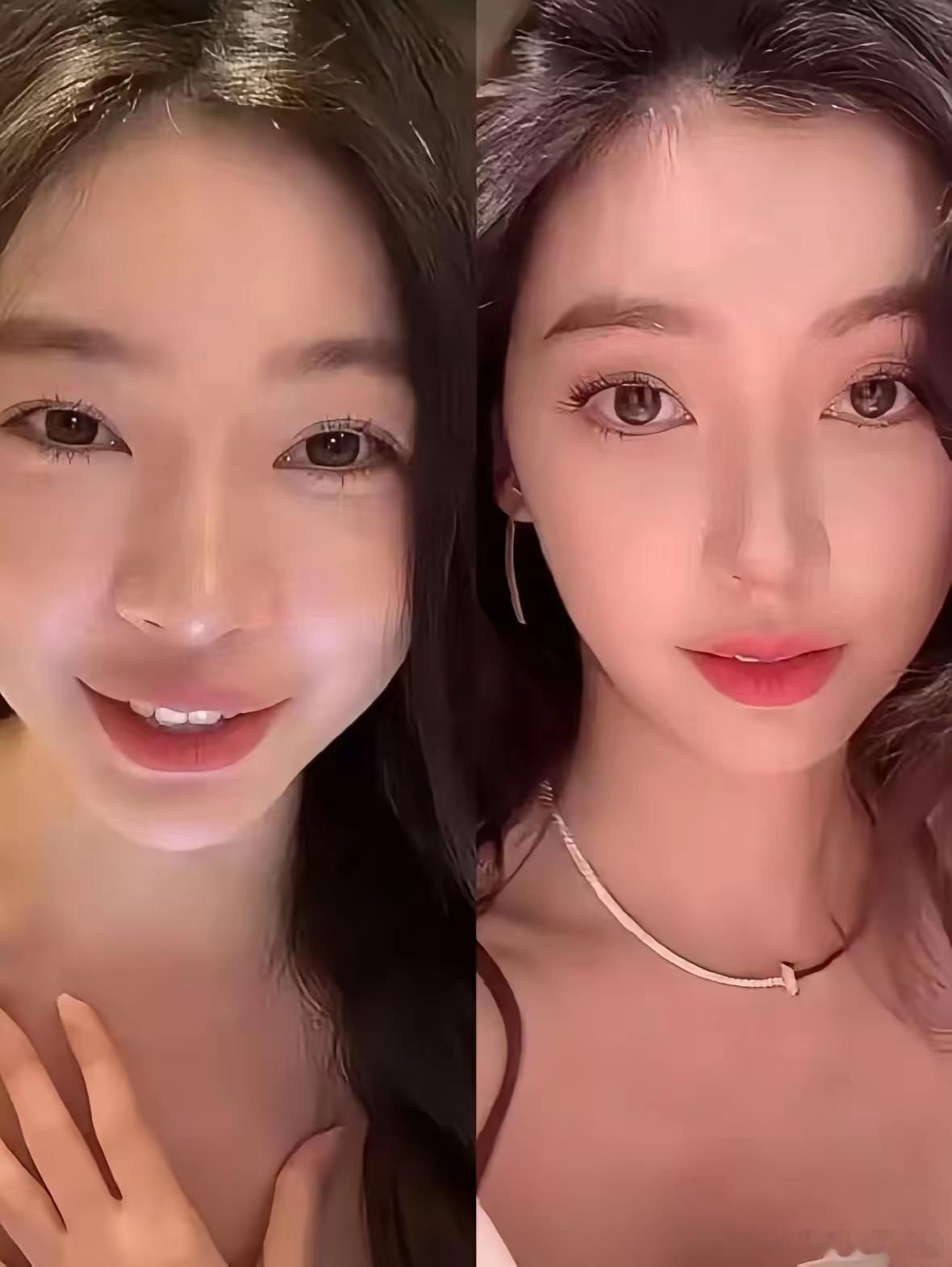 曝易梦玲整容从普通女网红到美出新高度，她到底做了哪些？好像下巴收了收，鼻子更加立