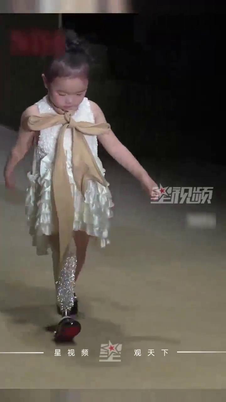3岁钢腿女孩走T台，自信的她闪闪发光。星视频观天下。近日浙江杭州，3岁钢腿女