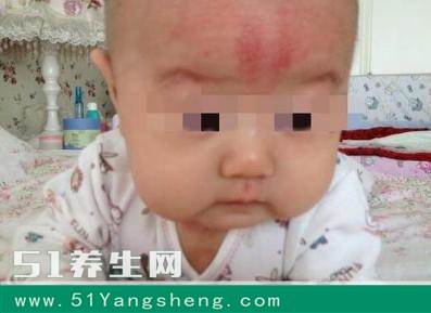 孩子半夜啼哭, 父母没在意继续哄睡, 第二天送到医院却晚了