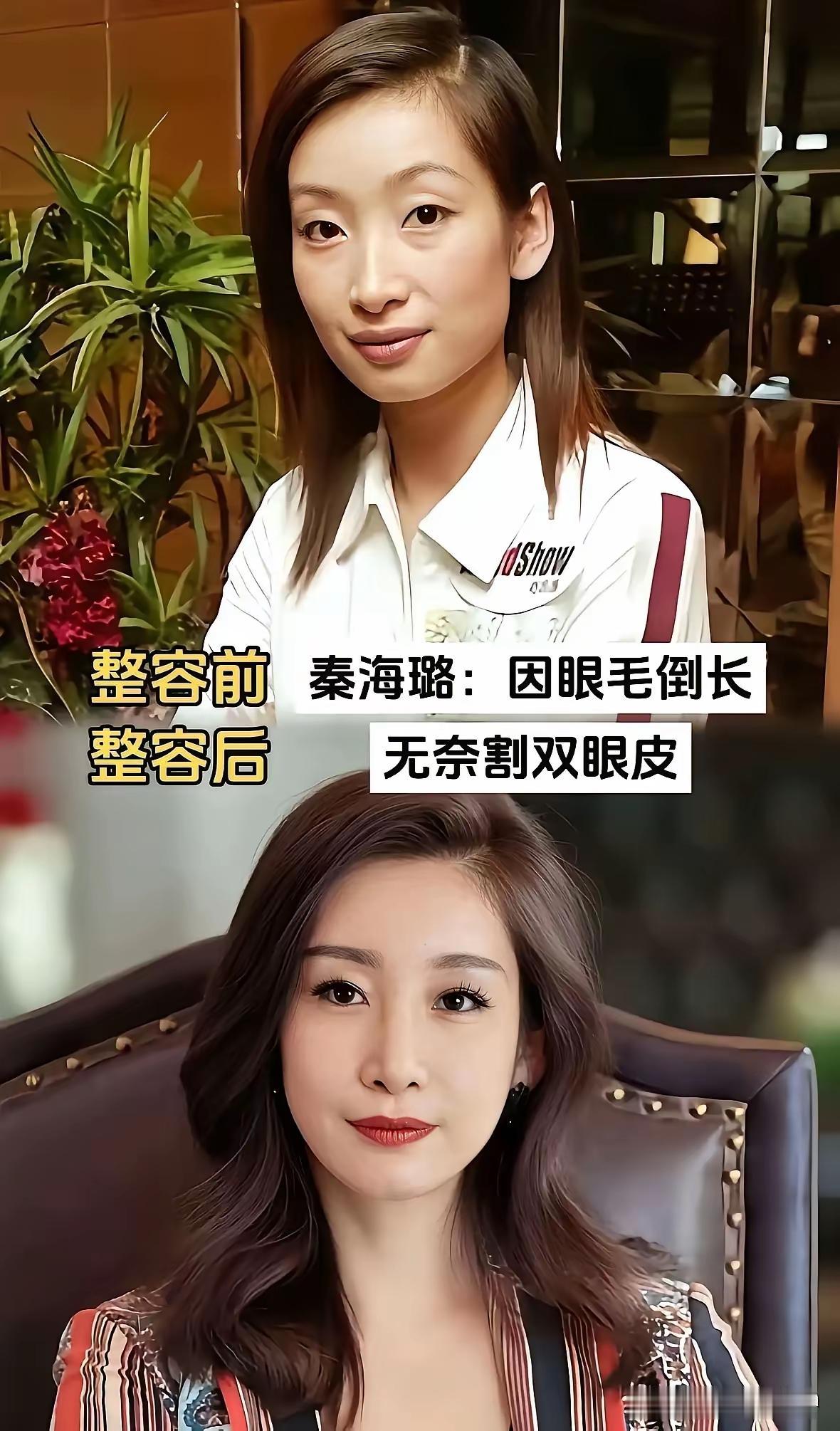 大大方方承认整容真的是挺好的！现在这时代又不是以前了，大多数人都整容，没什么好奇