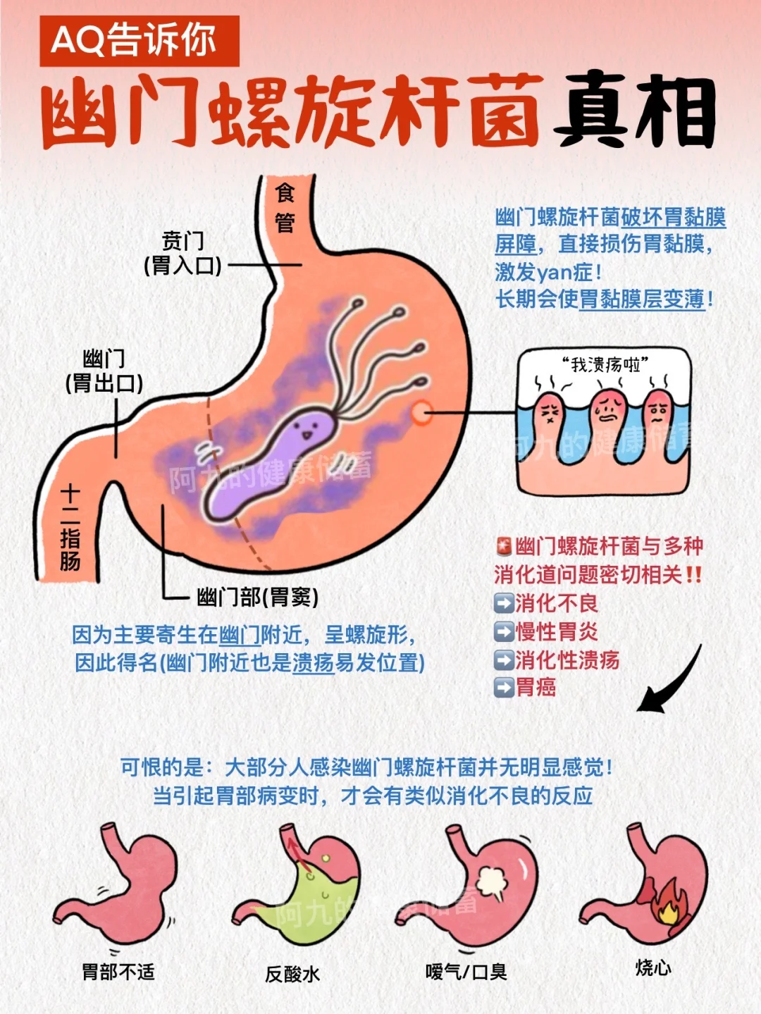 和解还是根除？幽门螺旋杆菌你一定要知道