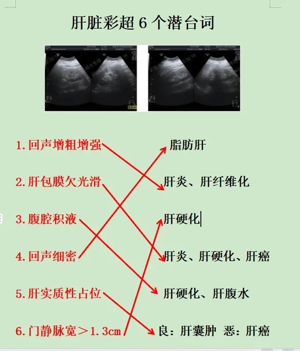 乙肝 肝脏彩超 肝硬化 健康科普 肝病教授陈士俊