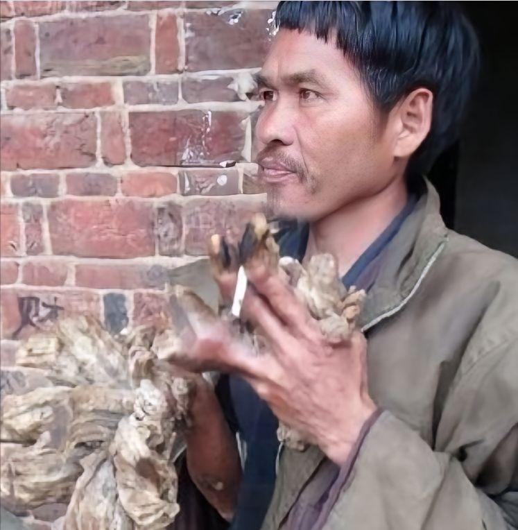 1992年，湖南农民刘忠文在村口野塘摸鱼，左手被一条彩鳞鱼划了道口子。他本以为嚼