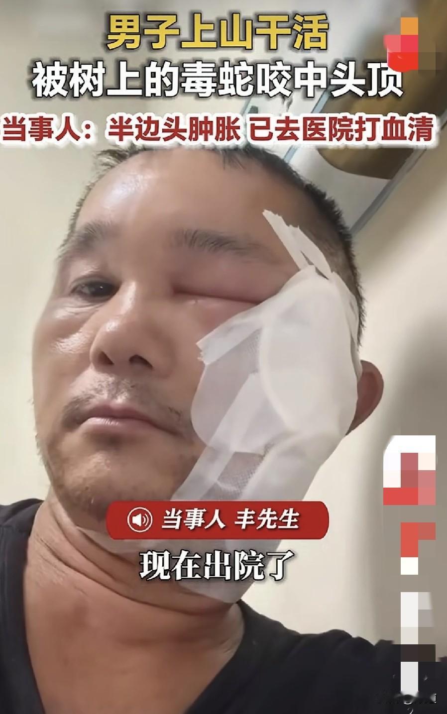 真是让人哭笑不得。近日，广西百色的丰先生去地里干活儿时，路过一棵树，这棵树不高