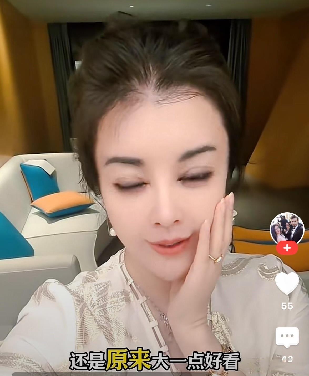 于文红眼睛做太多次，一侧眼睛都闭不严实了，看着怪吓人的。美颜开到最大，80岁老