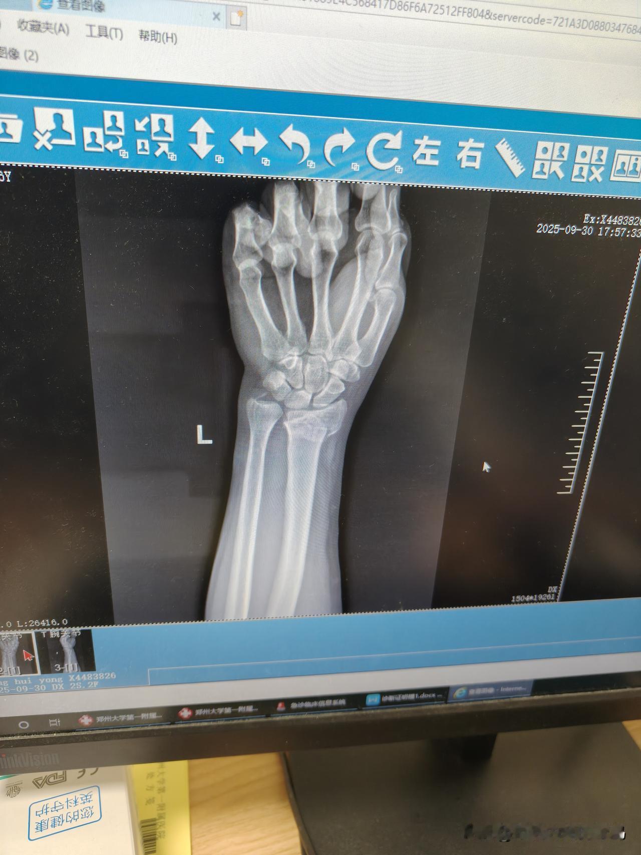 到底西医刀到病除，还是中医妙手回春?霉气都是自找的！节前最后一天，大晴天