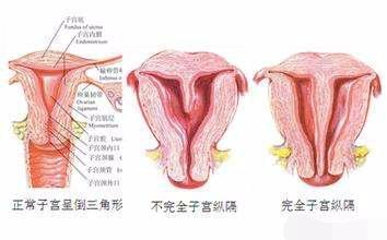 宫寒让她几度绝望, 老公的陪伴让她终于有了完整的家