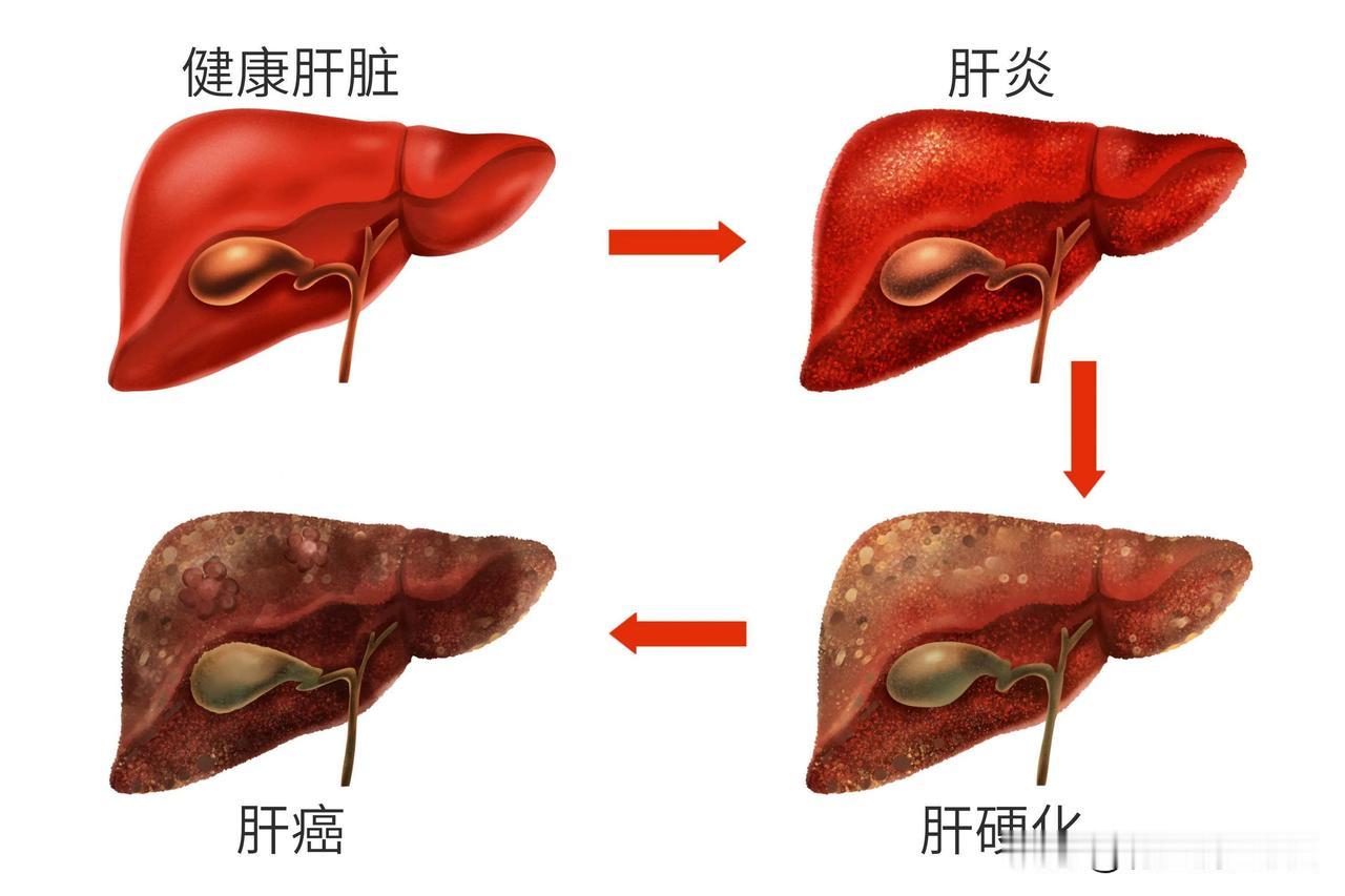 肝为刚脏，体阴而用阳，中医看肝脏的“双面性格”中医常说“肝为刚脏，体阴而用