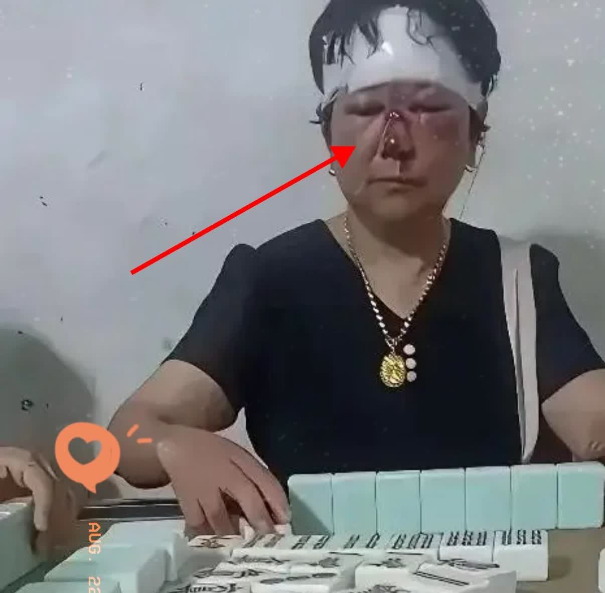 一名女子晚上去麻将馆找丈夫，瞧见桌上有个女的，脑袋和鼻子都受了伤，却还兴高采烈地
