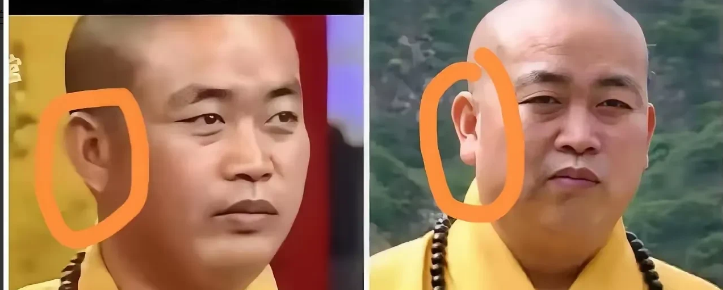 释永信的耳垂是假的？网友说这是打了玻尿酸为什么这样子说呢有网友扒出释永信