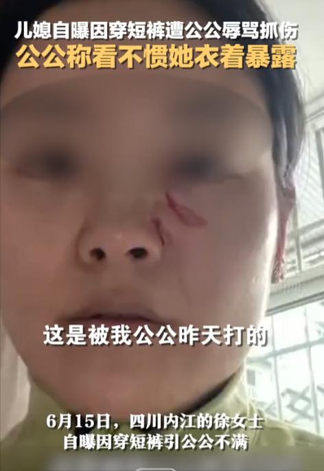 四川离谱家庭冲突！儿媳因为天热穿白色短裤，却被50多岁公公当众怒骂，两人大打出手