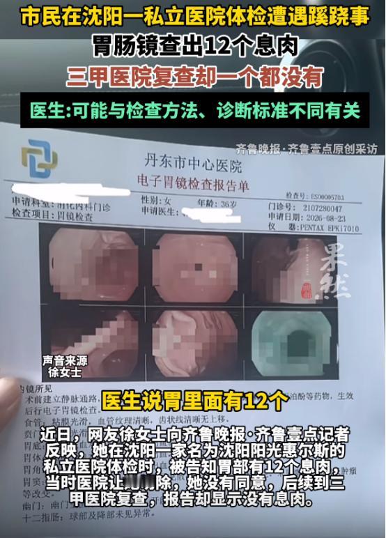丧尽天良！8月22日辽宁沈阳，女子陪丈夫参加单位体检，顺手做了个胃肠镜。麻