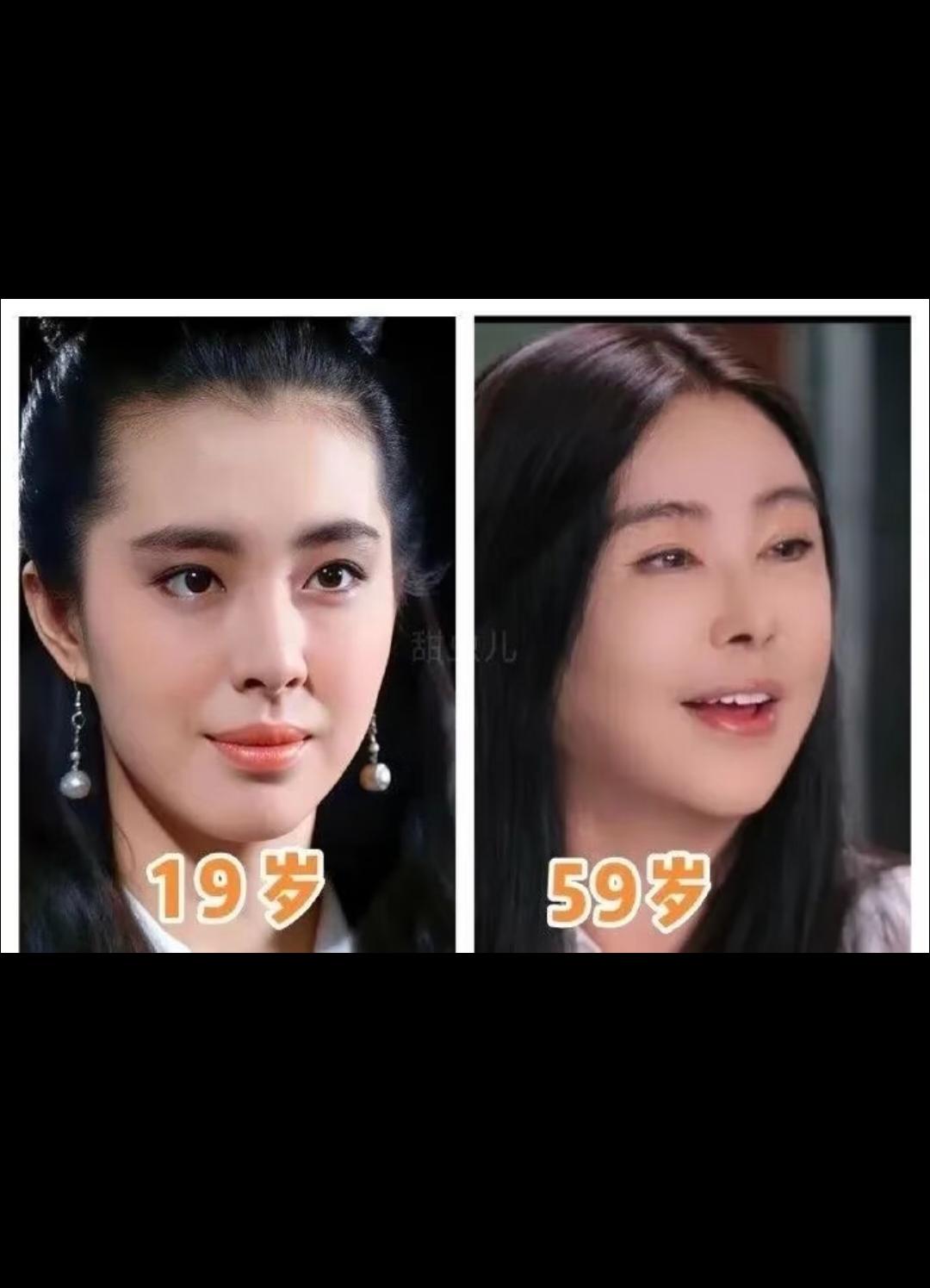 看了她很多对比照，发现她竟没有皱纹，苹果肌也没有松弛！大概率是做医美了，而且看