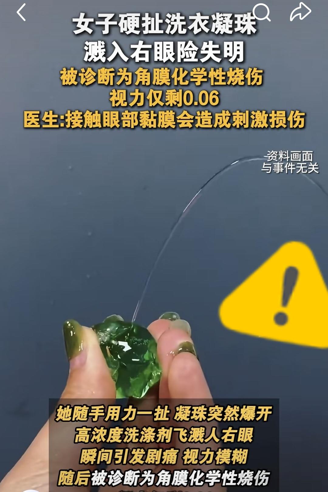 洗衣凝珠不要硬扯，硬挤‼️最近一女子硬扯洗衣凝珠溅入眼睛视力仅剩0.06，差