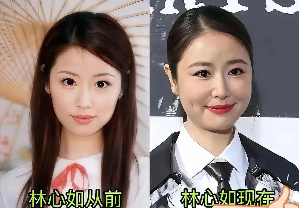 林心如年轻时候的她满脸胶原蛋白,皮肤白皙,白里透着红,五官精致，浑身散发着迷人的