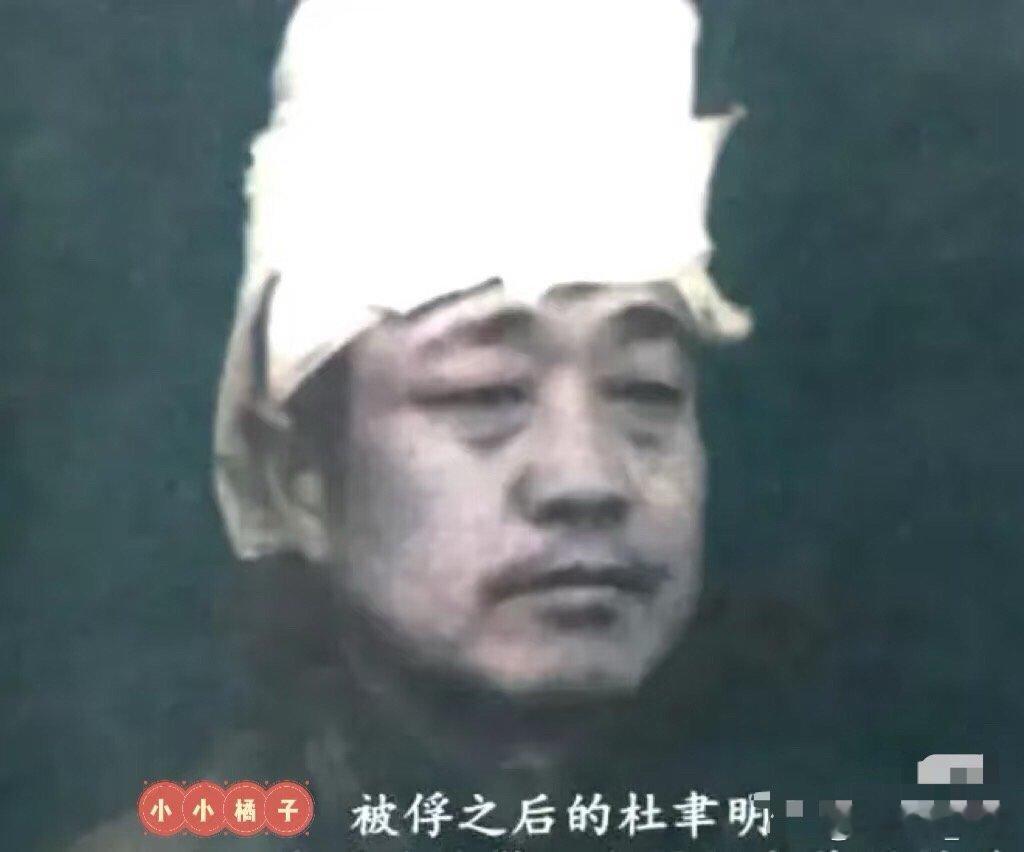 1949年，杜聿明被俘之后自杀未遂的照片，镜头中的他神情黯淡，头上已经包扎好了伤