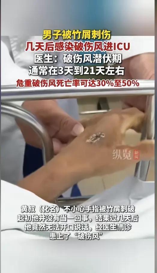 “一条小竹屑竟能要了命？”近日，广东梅州，一男子干活时，不小被竹屑刺进了手背，男