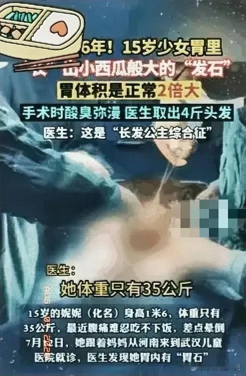 震惊！河南一女孩因腹痛吃不下饭，去医院看病，不料，医生竟从她的胃里，发现一颗堪