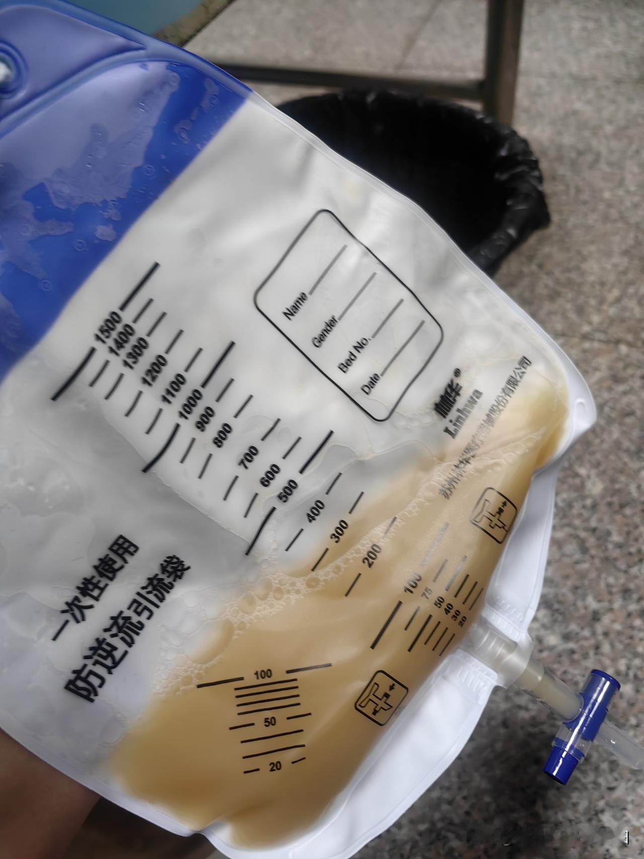 老公昨天晚上就开始发烧，量体温38.9，今天一白天还是高烧不退，尿也有脓，人也喘