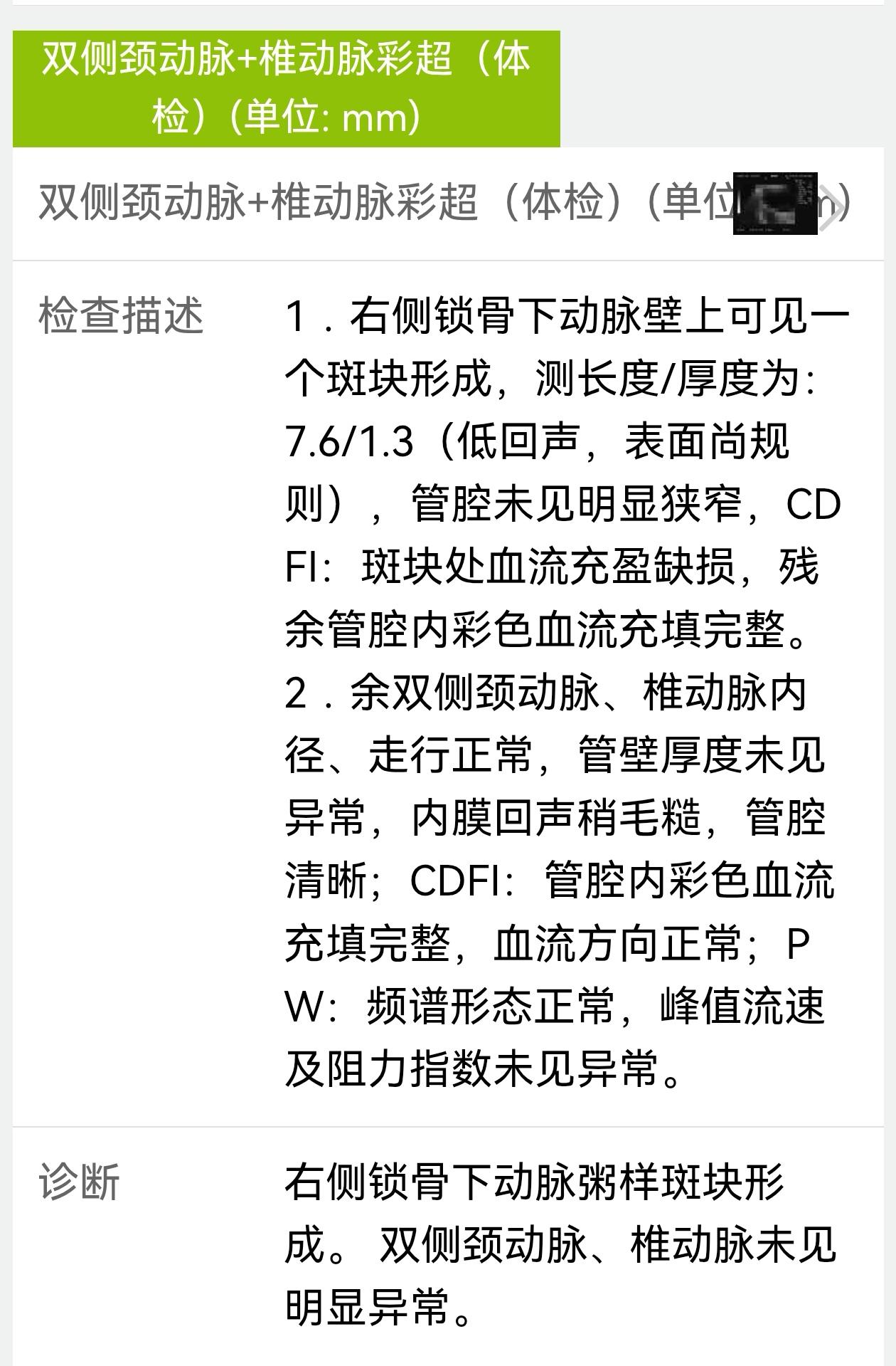 吃燕麦饭胸口会不舒服，怎么办呢？我的低密度胆固醇3.09，锁骨那里有个低回声