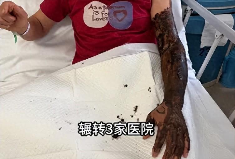 “悲剧还是发生了！”7月17日报道，安徽，一女子熟睡时，突然被一阵刺痛惊醒，她发