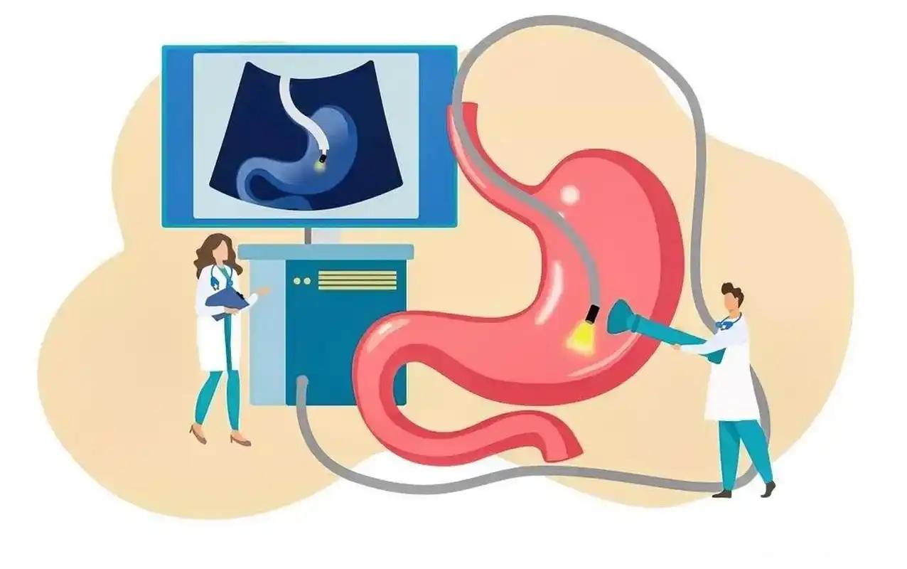 每天大便三四次，胃镜没查出问题，做了内镜超声确诊癌王你敢信？天天跑厕所排便，胃