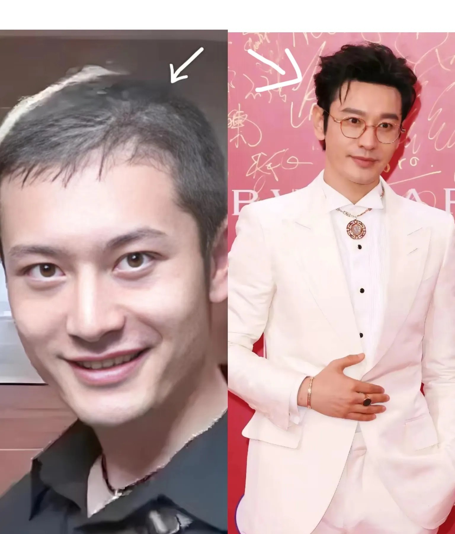 一觉醒来，黄晓明的天塌了不是叶珂又给他挖坑，也不是他的英文口语又被网友吐槽，而